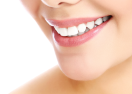 Bonding | Cosmetic Dentistry | Smiles by German Design | Muenster TX