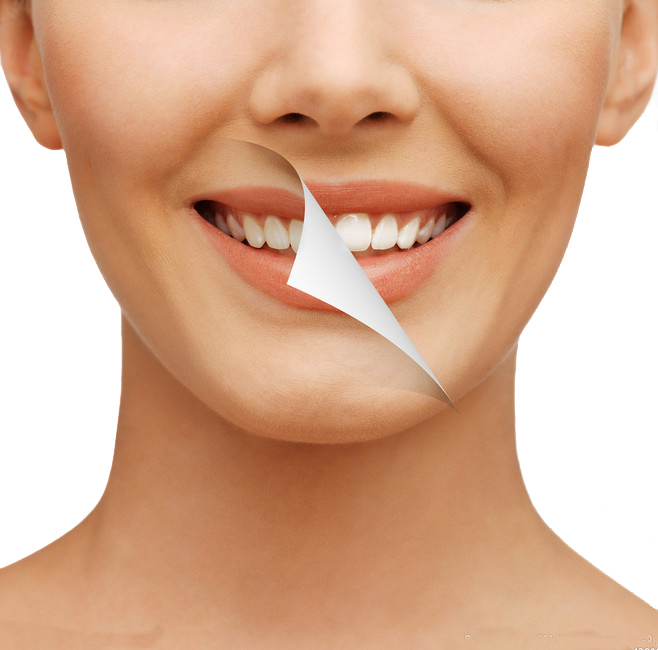 Teeth Whitening | Muenster TX